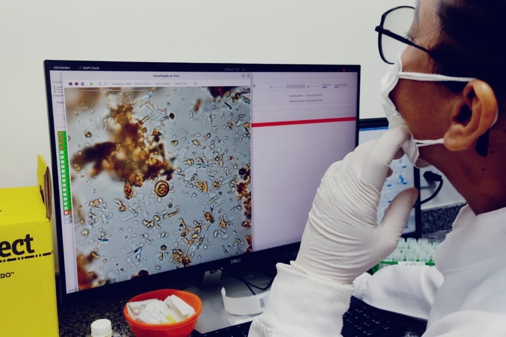 Manaus inaugura novo laborat&oacute;rio automatizado de diagn&oacute;stico de parasitas