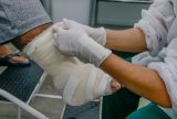 Médico alerta para risco de pé diabético em pacientes