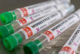 Anvisa renova dispensa de registro de duas vacinas contra mpox