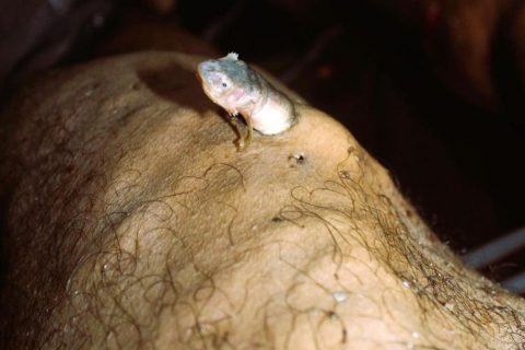 Perita do IML do Amazonas vence concurso nacional com foto de candiru em cadáver
