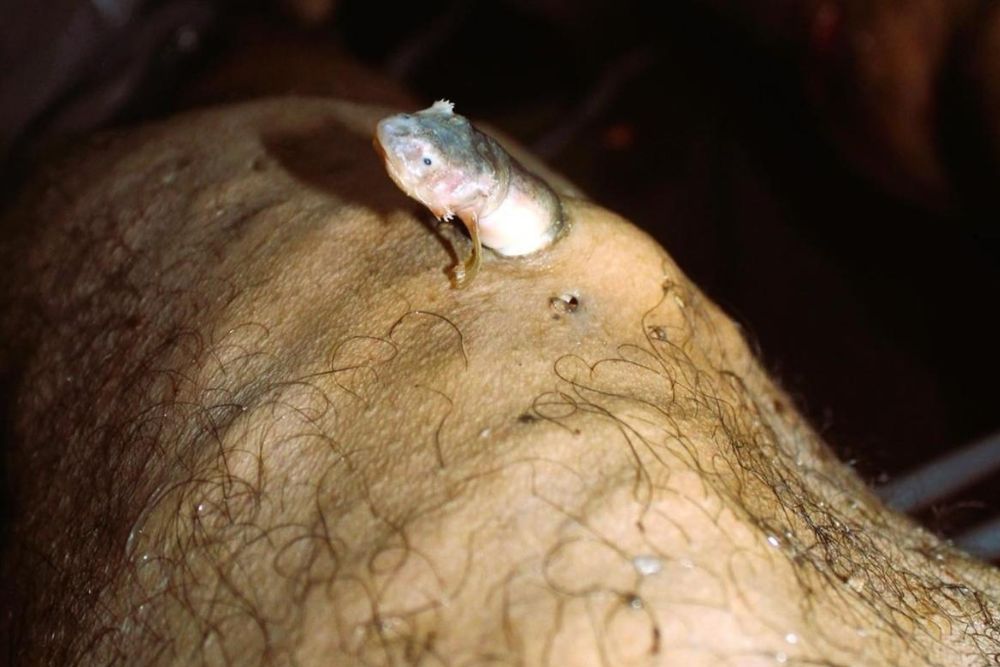 Perita do IML do Amazonas vence concurso nacional com foto de candiru em cadáver Perita do IML do Amazonas vence concurso nacional com foto de candiru em cadáver