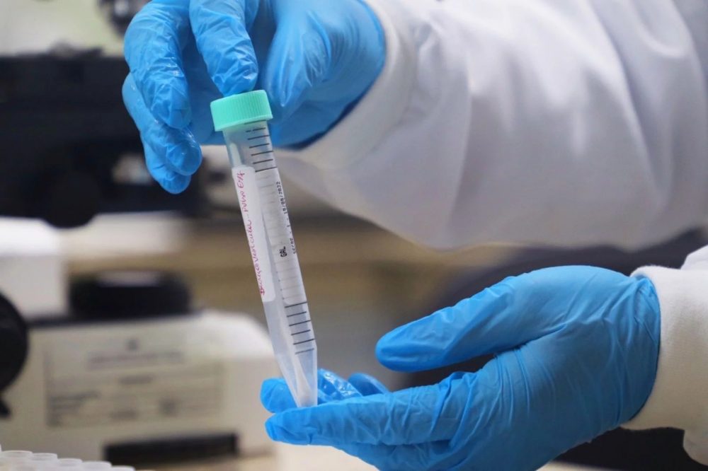 Amazonas registra 107 casos notificados de Mpox, aponta boletim Amazonas registra 107 casos notificados de Mpox, aponta boletim
