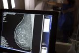Mamografia cresce entre mulheres de 50 a 69 anos no Brasil, aponta pesquisa