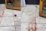 Barbeiro e cliente são baleados durante ataque criminoso no Mundo Novo
