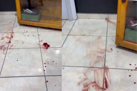 Barbeiro e cliente são baleados durante ataque criminoso no Mundo Novo