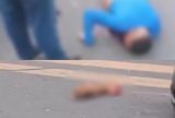 Motociclista colide com carro e tem mão decepada em acidente na Zona Norte de Manaus
