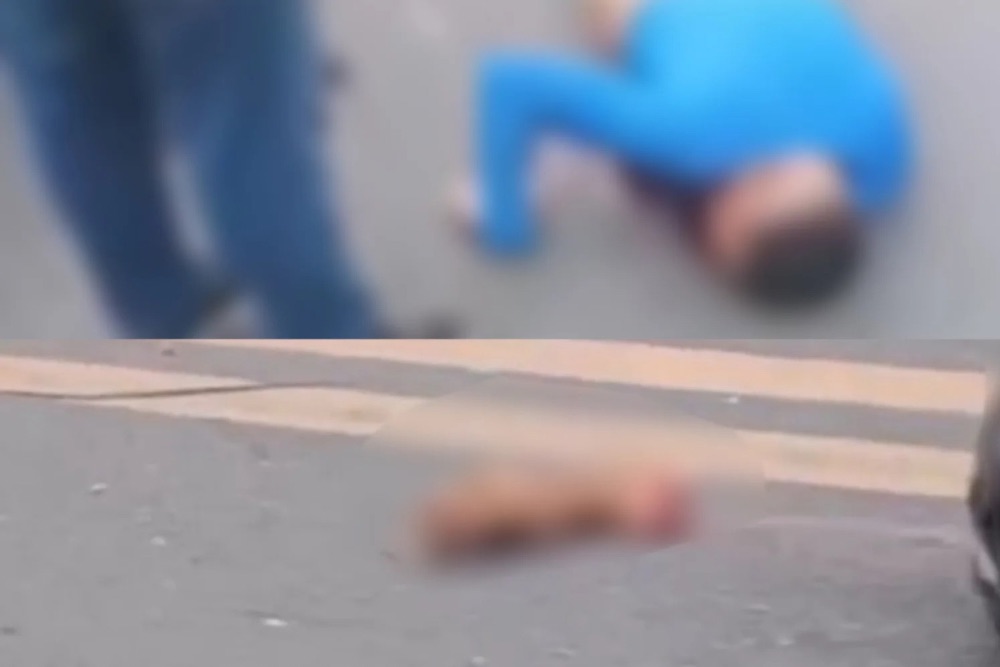 Motociclista colide com carro e tem mão decepada em acidente na Zona Norte de Manaus