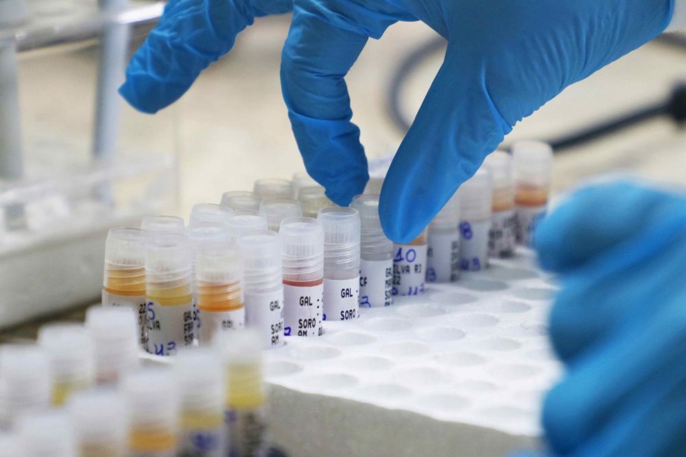Amazonas registra 78 casos confirmados de Mpox, aponta FVS-RCP