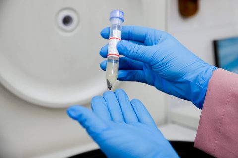 Pesquisa identifica zoonoses em carnes de animais silvestres no Médio Solimões