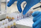 Amazonas registra 14 casos confirmados de Mpox em 2025