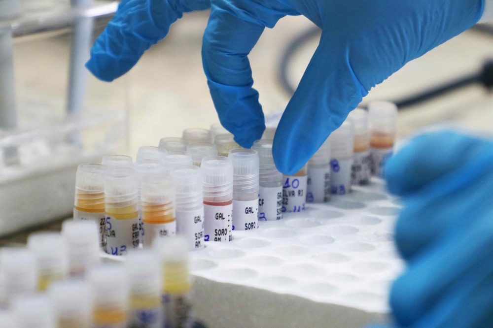 Amazonas registra 14 casos confirmados de Mpox em 2025 Amazonas registra 14 casos confirmados de Mpox em 2025