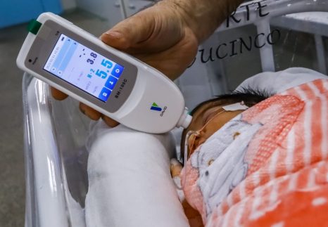Maternidade Ana Braga revoluciona diagnóstico de icterícia neonatal com tecnologia de ponta