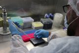 Amazonas registra 15 casos confirmados de Mpox de janeiro a março deste ano