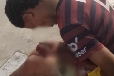 Homem pede socorro em avenida após levar tiro na mão em Manaus