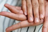 Conheça 4 alterações nas unhas que podem indicar problemas de saúde