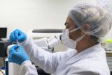 Amazonas registra 30 casos confirmados de Mpox em 2025