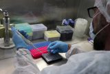 Amazonas não registra novos casos de Mpox na última semana, aponta FVS-RCP