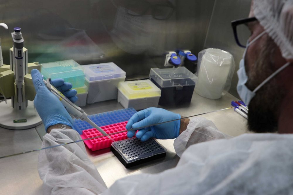 Amazonas não registra novos casos de Mpox na última semana, aponta FVS-RCP Amazonas não registra novos casos de Mpox na última semana, aponta FVS-RCP