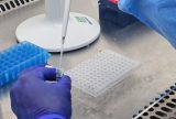 Casos e óbitos por vírus respiratórios caem no Amazonas em 2025, aponta boletim