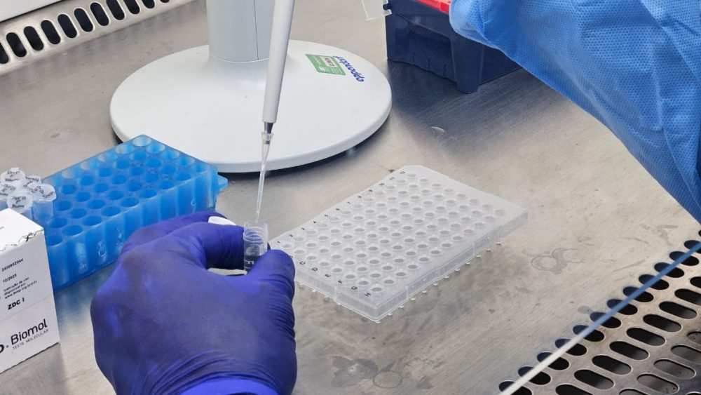 Casos e óbitos por vírus respiratórios caem no Amazonas em 2025, aponta boletim Casos e óbitos por vírus respiratórios caem no Amazonas em 2025, aponta boletim