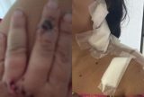 Mãe e bebê são atacadas com gargalo de cerveja na zona Norte de Manaus