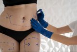 Relatório internacional aponta Brasil como país que mais realiza cirurgias estéticas
