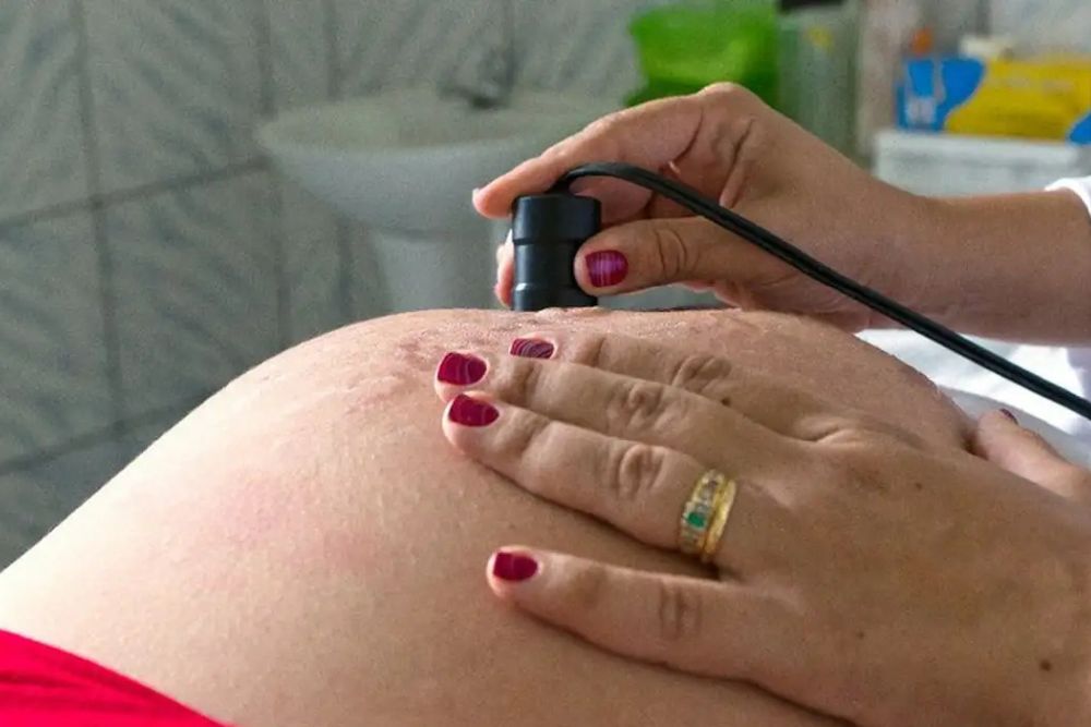 Pr&eacute;-natal eficaz reduz risco de anomalias cong&ecirc;nitas em rec&eacute;m-nascidos