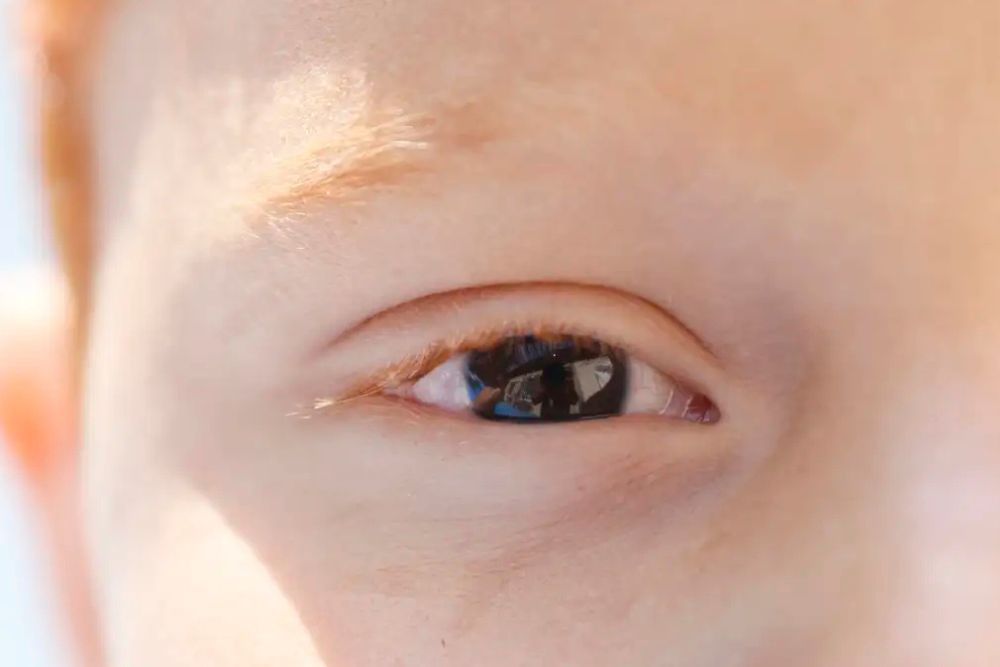 Erros de refração lideram casos de deficiência visual em crianças