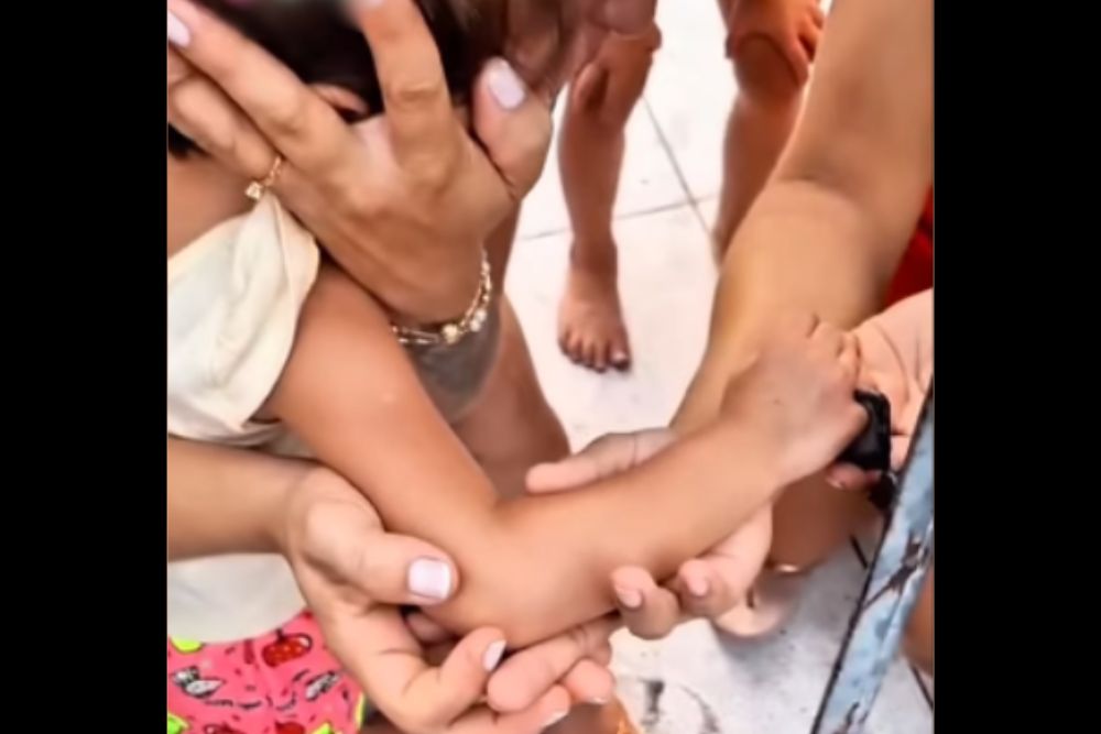 Bombeiros resgatam criança de 3 anos após prender dedo em portão em Manaus