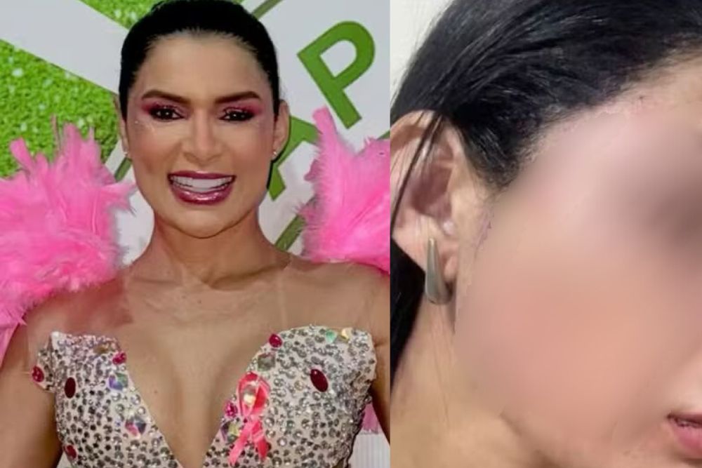 Musa de escola de samba denuncia agressão durante corrida de moto por aplicativo em Manaus