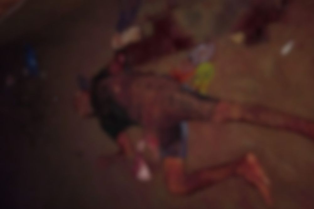 Homem morre após ter braço amputado em ataque violento no interior do Amazonas