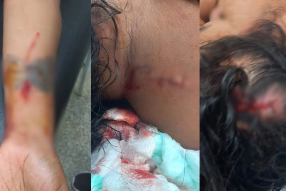 Homem agride companheira com garrafa ap&oacute;s discuss&atilde;o sobre paternidade em Manaus