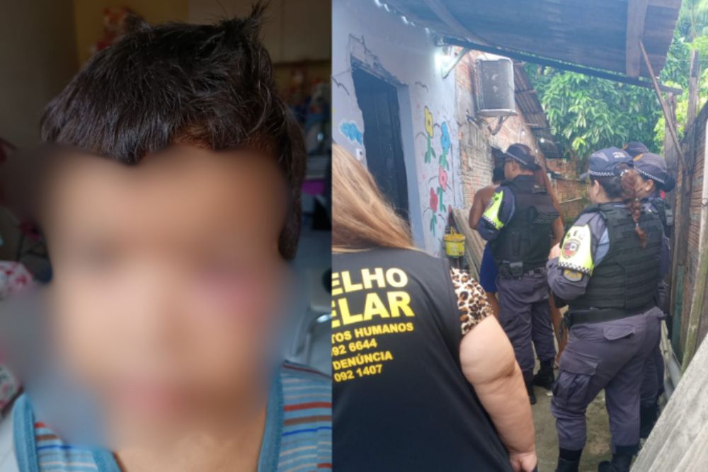 Criança de 5 anos sofre agressões na zona norte de Manaus; padrasto é investigado