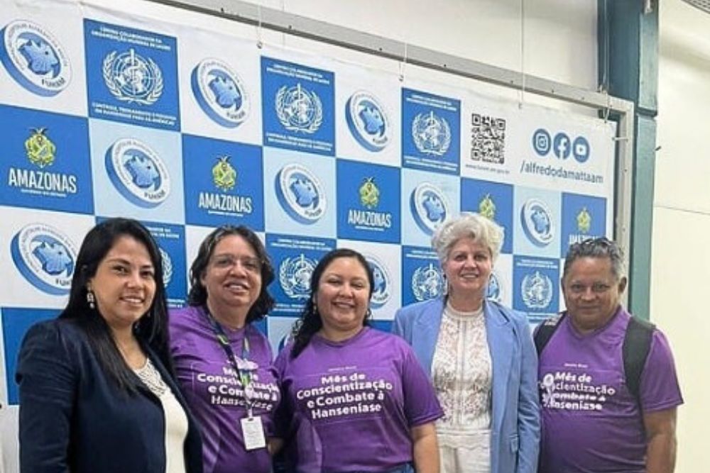 Fuham firma parceria com ONG para fortalecimento da produção de calçados terapêuticos
