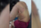 Homem ateia fogo na ex-companheira e filho em Parintins