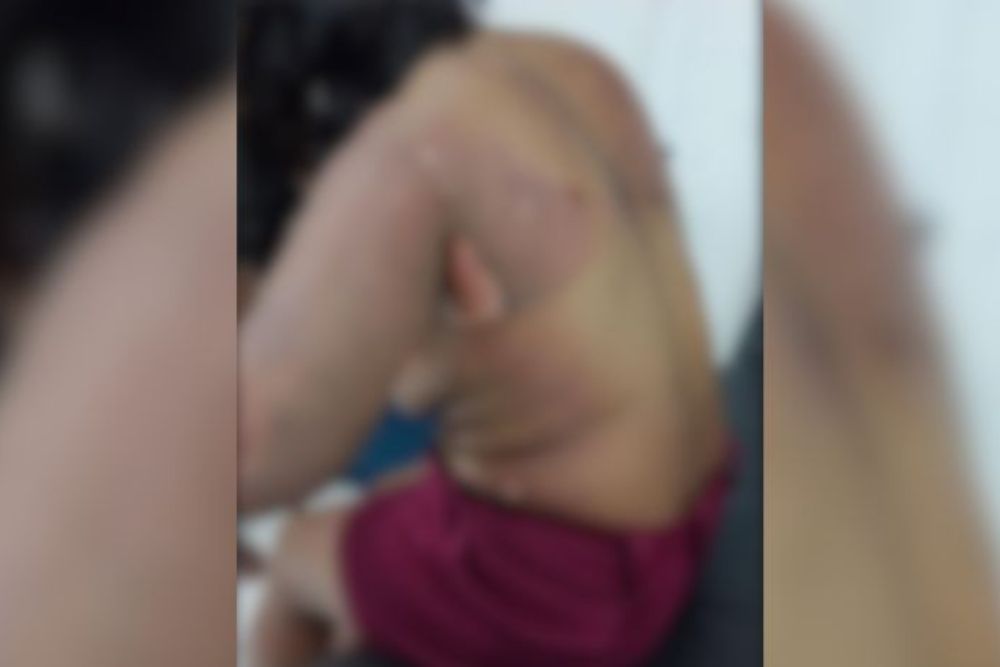 Homem ateia fogo na ex-companheira e filho em Parintins