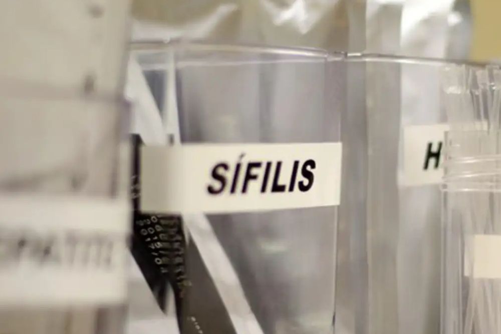 SUS passa a adotar antibi&oacute;tico para prevenir s&iacute;filis e clam&iacute;dia