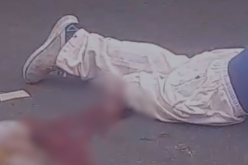 Motociclista tem perna amputada após grave acidente na zona oeste de Manaus