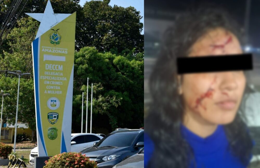 Mulher &eacute; ferida com estilha&ccedil;o de prato pelo ex-companheiro em Manaus