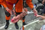 Menina de 4 anos prende dedo em pote de massinha na Zona Sul de Manaus