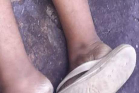 Homem é encontrado morto com tiros na cabeça em área da Ponta Negra