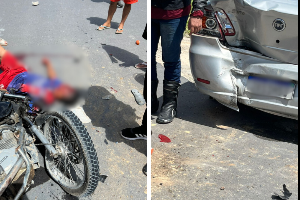 Colisão entre moto e carro deixa casal gravemente ferido na rodovia AM-010 Colisão entre moto e carro deixa casal gravemente ferido na rodovia AM-010