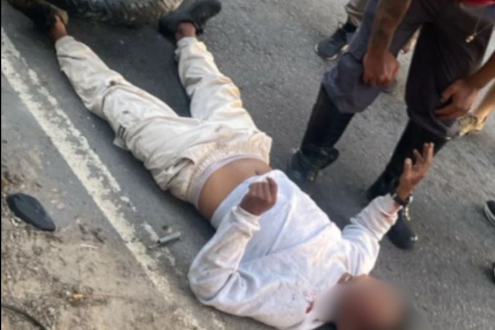 Motociclista fica gravemente ferido após acidente na avenida Cosme Ferreira, em Manaus