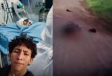 Jovem morre após dias internado por atropelamento em Maués