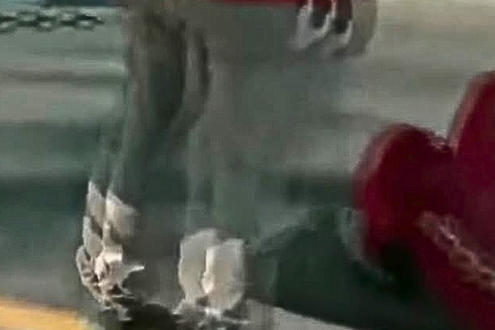 Homem é atropelado na Estrada dos Franceses e aguarda socorro no meio-fio
