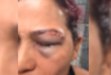 Atleta relata agressão cometida pelo ex-companheiro na zona oeste de Manaus