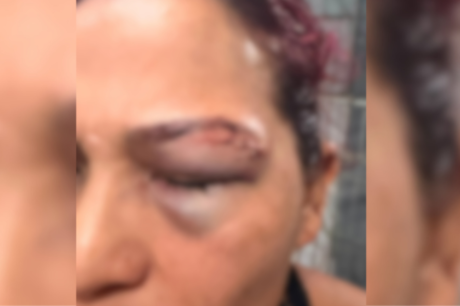 Atleta relata agressão cometida pelo ex-companheiro na zona oeste de Manaus