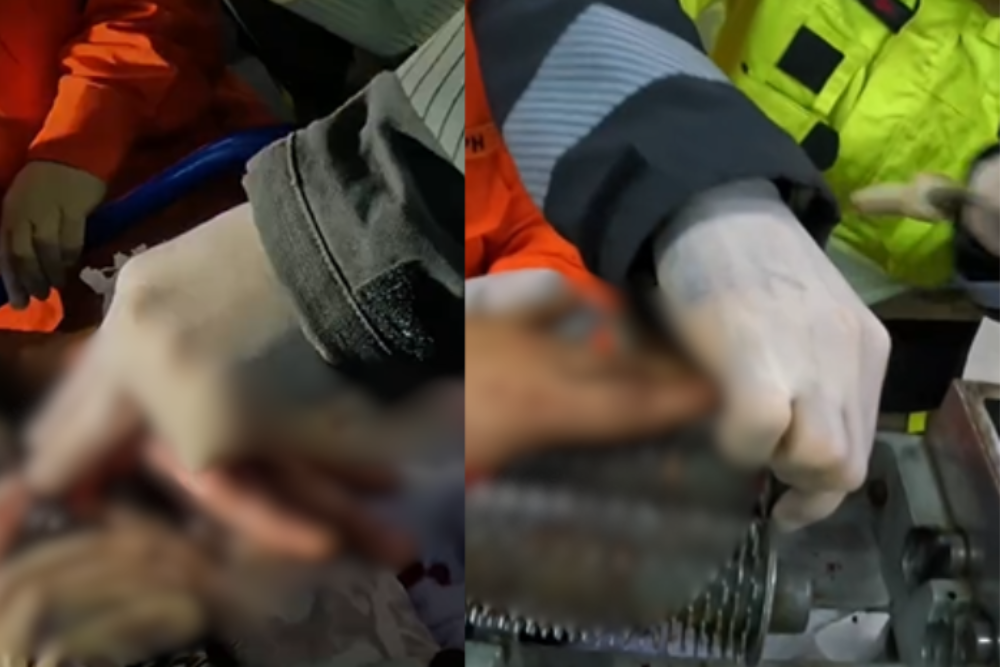 Trabalhador tem dedo preso em m&aacute;quina de amaciar carne em Manaus