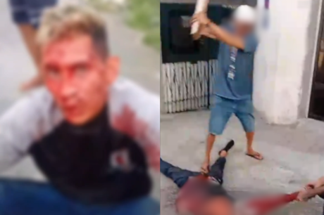 Suspeito de assalto é ferido por moradores após esfaquear vítima em Manaus
